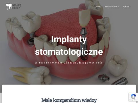 Implantologia.pl